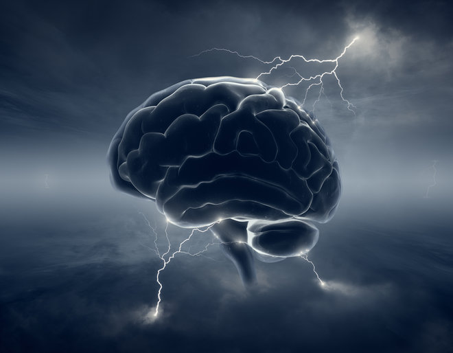 DARPA Wants to Zap Your Brain to Boost Your Memory