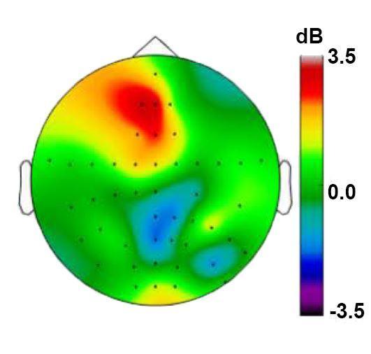 Deep stimulation improves cognitive control by augmenting theta brain rhythms