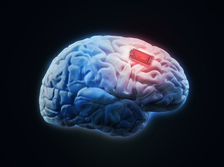 Brain Implants Made of Graphene - What is Possible?