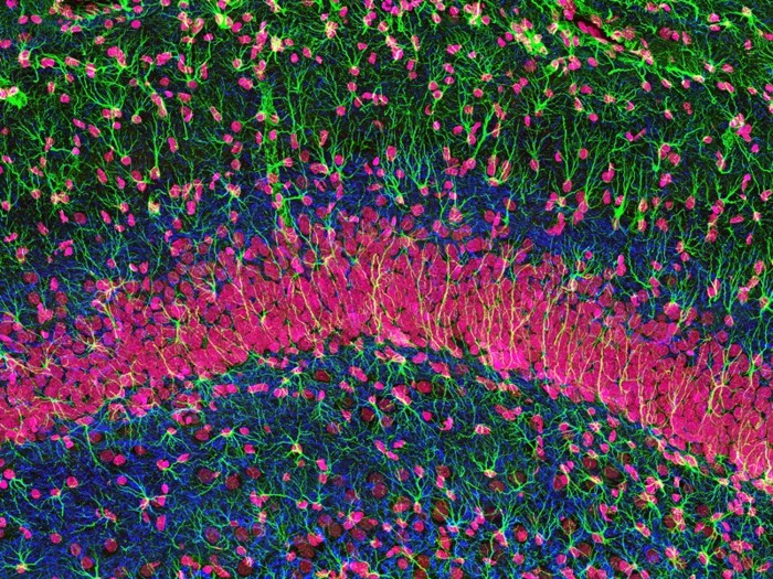 Neurons that bloom in adulthood show off fancy patterns
