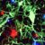 Mouse study shows microglia not just trash disposal, but essential to healthy neuron balance