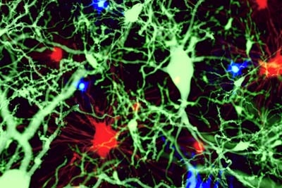 Mouse study shows microglia not just trash disposal, but essential to healthy neuron balance
