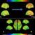 Scientists show how brain flexibility emerges in infants