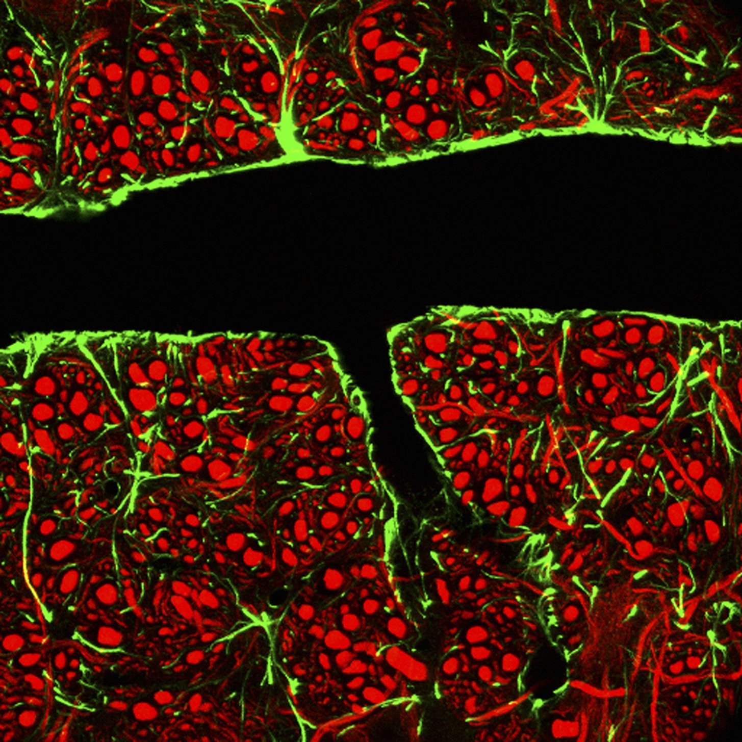 Searching for the Secret of How Young Blood Rejuvenates the Brain