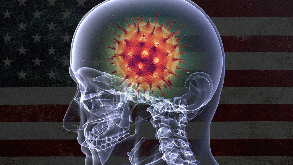 Study finds many Wuhan coronavirus infection survivors experience cognitive issues