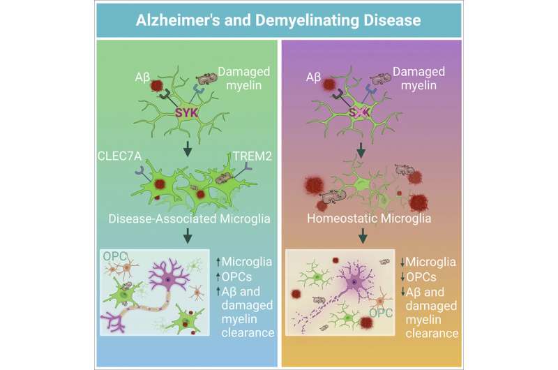 Brain discovery holds key to boosting body's ability to fight Alzheimer's, multiple sclerosis