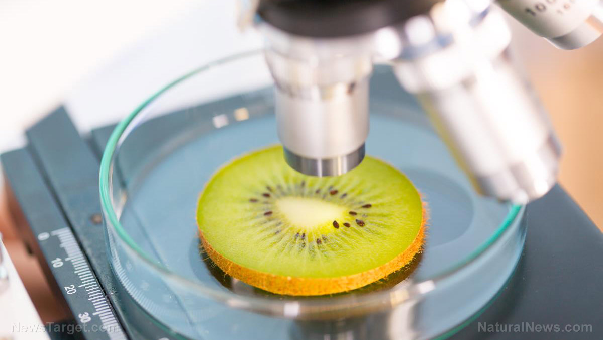 8 Science-backed health benefits of eating kiwi