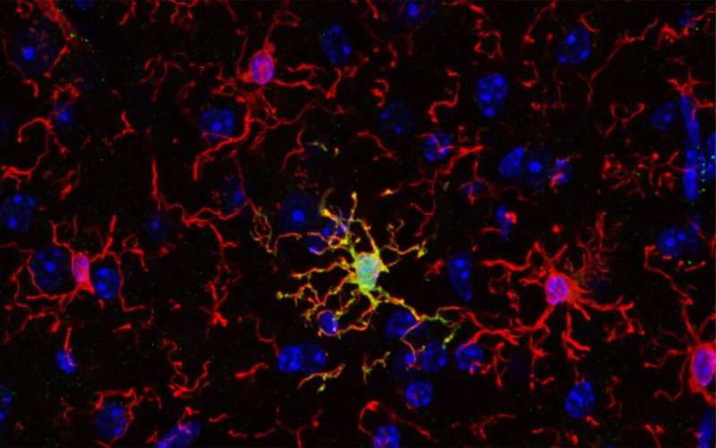 Immune cells of the brain are not all the same: New research could open novel therapeutic pathways