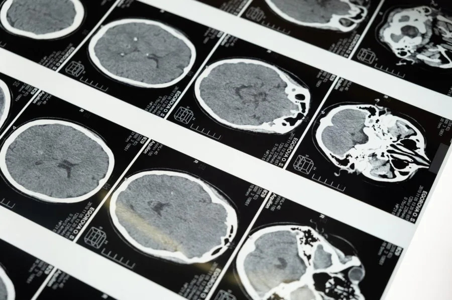 Researchers unveil atlas of human brain