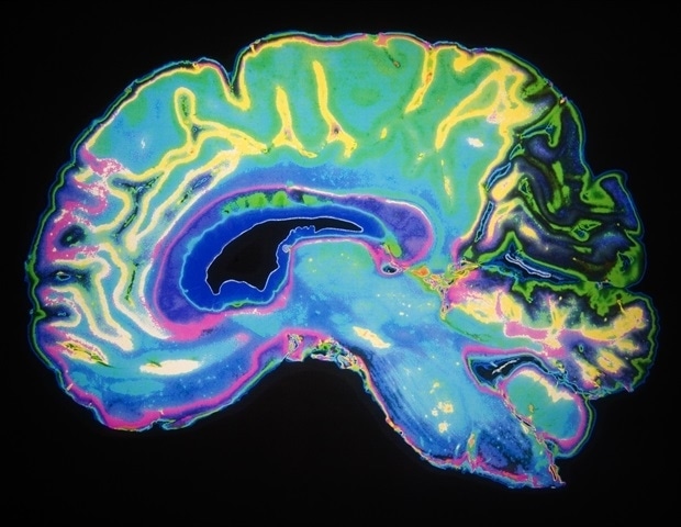 Dartmouth-led research identifies unique brain areas for emotion regulation