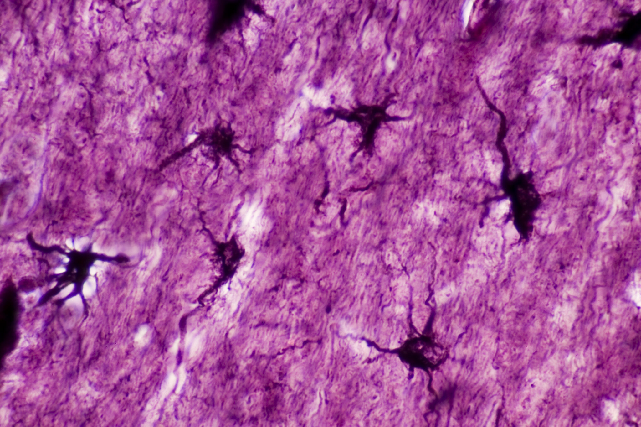 Tweaking non-neural brain cells can cause memories to fade